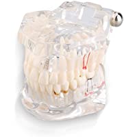 Akozon Modelo de Dientes dentales- Modelo de Dientes de enseñanza estándar Dental Modelo de dentadura para niños Modelo…